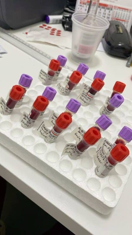 Blood sample vials in a laboratory for a typhoid blood culture test